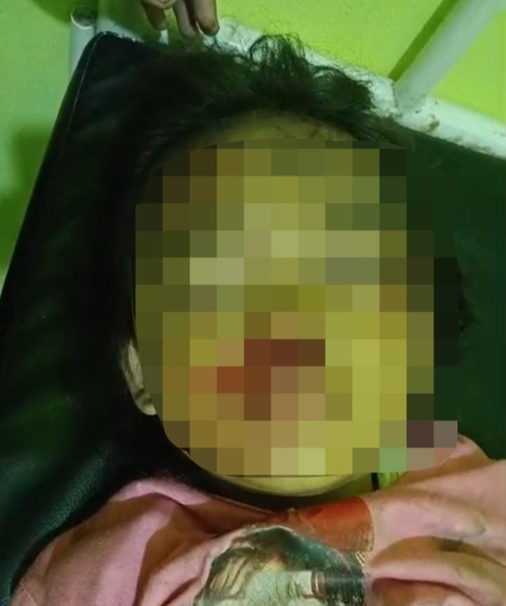 Subuh Mencekam di Rumah Sardo Purba, Putrinya Ditendang dan Diinjak Gajah Liar Saat Menyelamatkan Diri